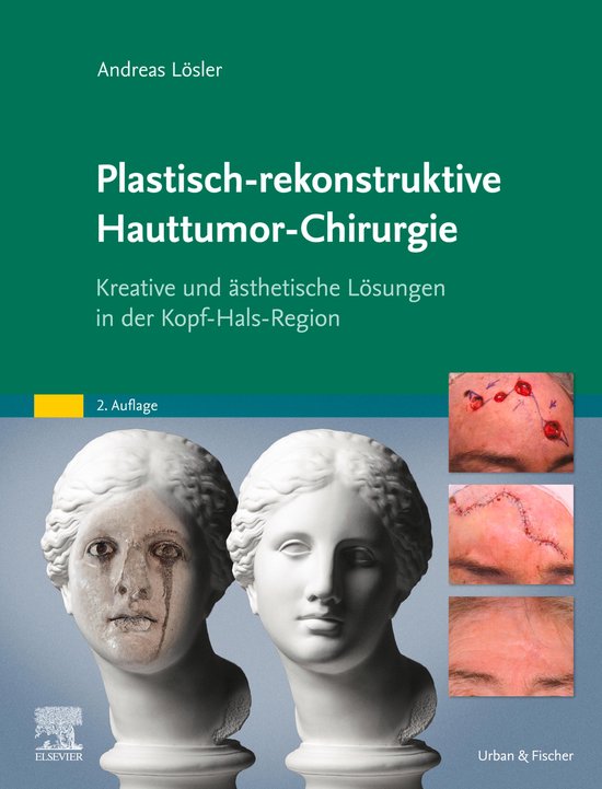 MONOGRAPHIE - Fachbuch - Urban & Fischer-Verlag - Plastisch- ... - cover
