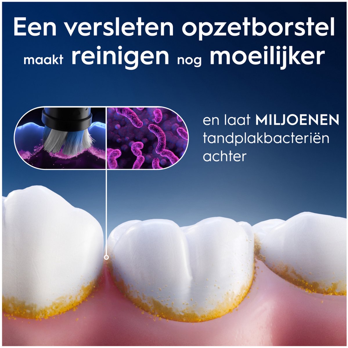 Oral-B iO Opzetborstels - Gentle Care thumbnail 6