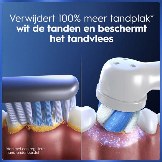 Vergelijking van tandenborstels: voor en na het poetsen met Oral-B iO. Toont verwijdering van tandplak.