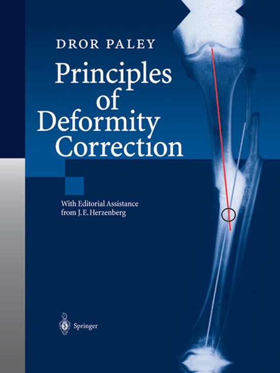Principles of Deformity Correction - cover