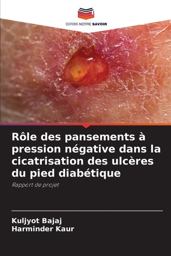Rôle des pansements à pression négative dans la cicatrisation des ulcères du pied diabétique