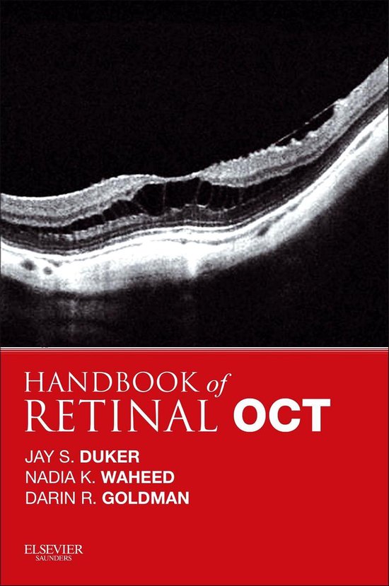Handbook of Retinal OCT: Optical Coherence Tomography E-Book
