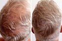 Voor en na vergelijking van grijs haar, waarbij IMPERIO haarvezels het haar voller en dikker laten lijken.
