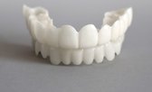 Snapon Smile nep tanden - boven en onder - Smile veneer - custom fit - wit gebit - witte tanden