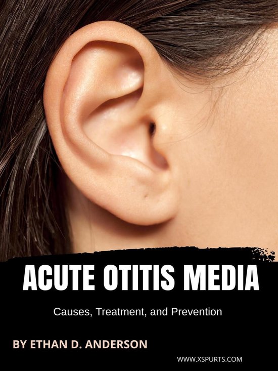 Acute Otitis Media: Causes, Treatment, and Prevention - cover