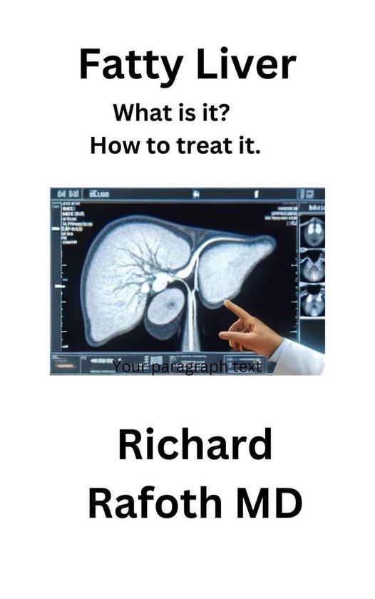 Fatty Liver - What is it? (ebook), Richard Rafoth MD | 9798224205981 ...