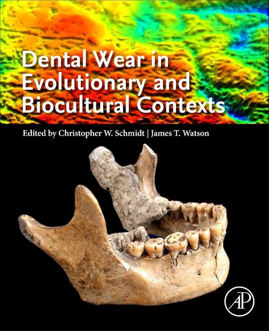Dental Wear in Evolutionary and Biocultural Contexts 9780128155998