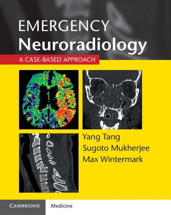 Emergency Neuroradiology - cover