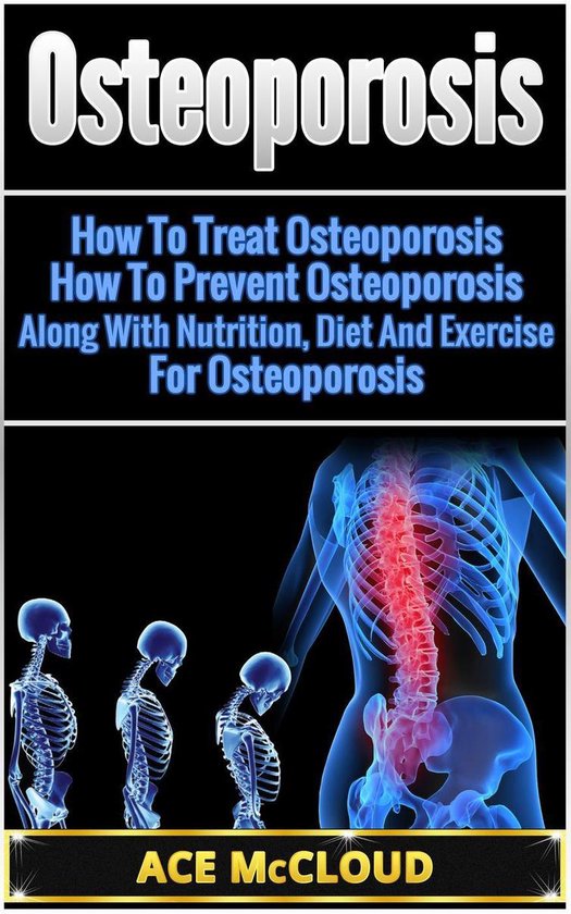 Osteoporosis: How To Treat Osteoporosis: How To Prevent Oste ... - cover