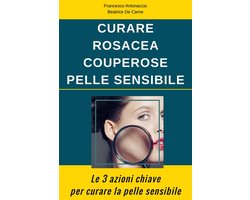 Curare Rosacea Couperose e Pelle Sensibile