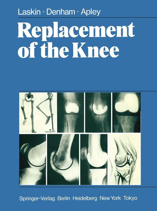Medicine (R0) - Replacement of the Knee - cover