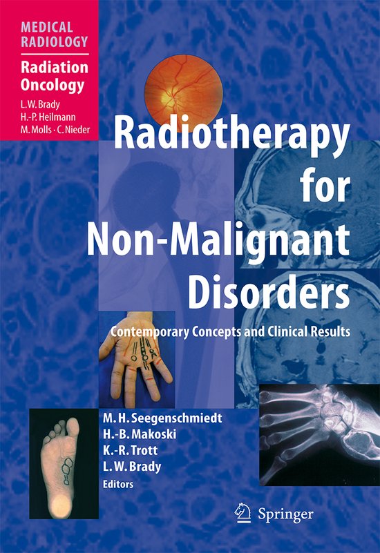 Radiotherapy for Non-Malignant Disorders - cover