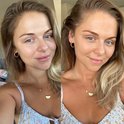 Vrouw met blond haar in een zomerjurk, vergelijking voor en na face tan.