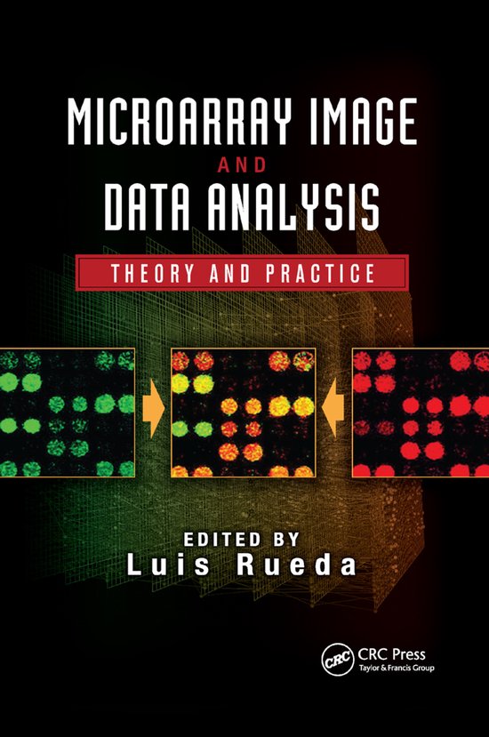 Digital Imaging and Computer Vision- Microarray Image and Data Analysis ...