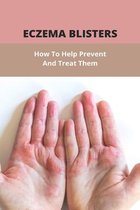 Eczema Blisters: How To Help Prevent And Treat Them