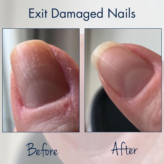 Herome Exit Damaged Nails Nagelolie Nagelversteviger – Nail Repair - Nagelverzorging met Voedende Amandel Olie - 7 ml - Herome