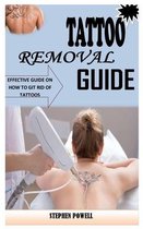 Tattoo Removal Guide