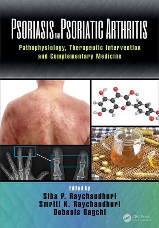 Psoriasis and Psoriatic Arthritis - cover