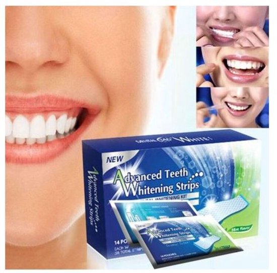 Dental 390 Teeth Whitening Strips 28x Tandenbleek Strips Zonder