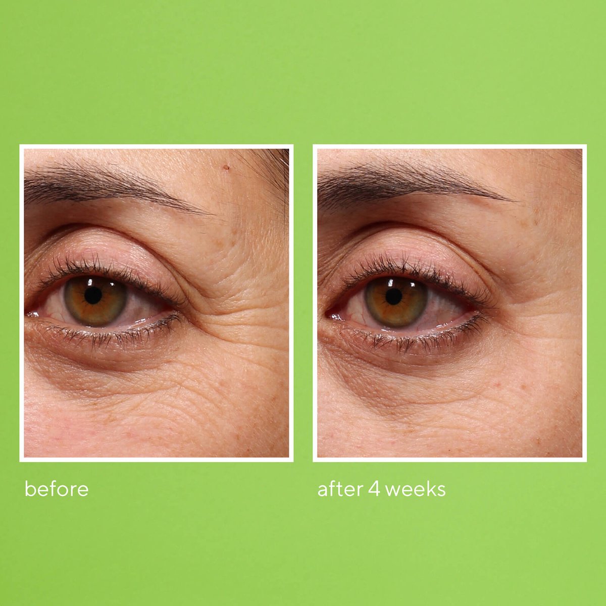 Murad - Retinol Youth Renewal Eye Serum - Rimpels en kraaienpootjes
