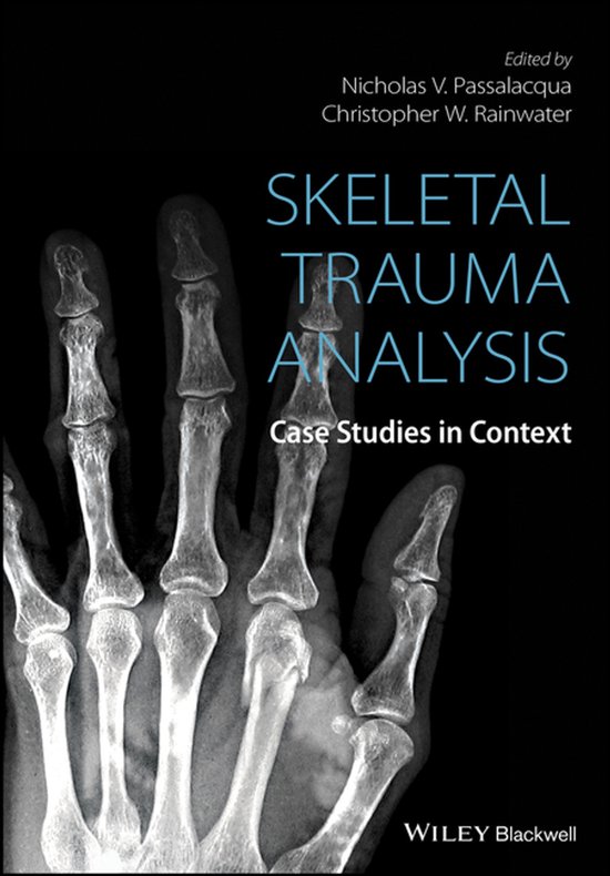 Skeletal Trauma Analysis - cover
