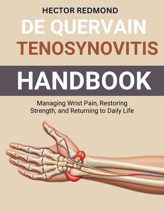 De Quervain Tenosynovitis Handbook - cover