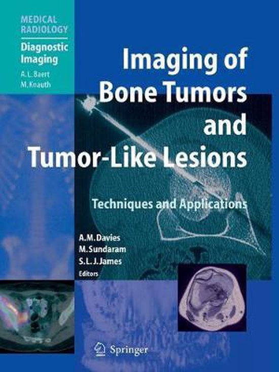 Medical Radiology- Imaging of Bone Tumors and Tumor-Like Les ... - cover
