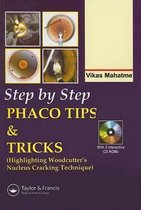 Step by Step Phacoemulsification
