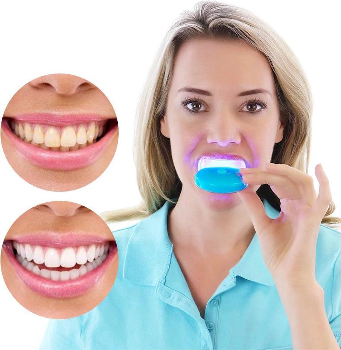 Tanden bitjes voor tanden bleken - vechtsporten - tanden knarsen (2 stuks)  | bol.com