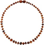 Barnsteen - Baby - Ketting Cognac - 32cm - Pijnverlichtend - Doorkomende Tandjes- Kraamcadeau - Zwanger