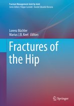 Fracture Management Joint by Joint- Fractures of the Hip