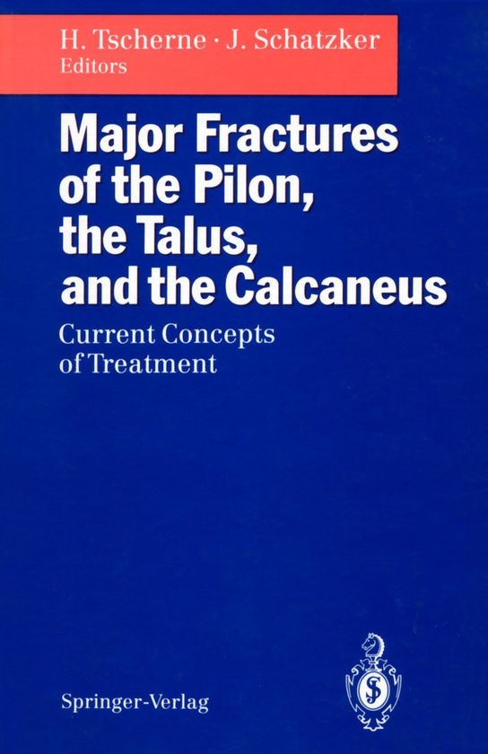 Major Fractures of the Pilon, the Talus, and the Calcaneus - cover