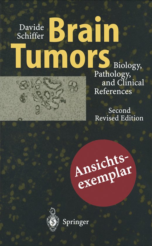 Brain Tumors - cover