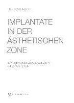 Implantate in der ästhetischen Zone