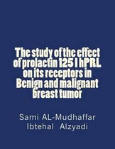 The study of the effect of prolactin 125 I hPRL on its receptors in Benign and malignant breast tumor