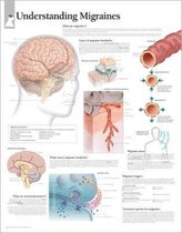 Understanding Migraines Laminated Poster
