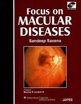 Focus on Macular Diseases