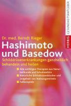 Hashimoto und Basedow