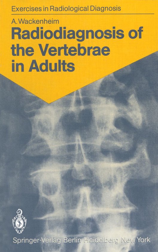 Medicine (R0) - Radiodiagnosis of the Vertebrae in Adults - cover