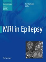 Medical Radiology - MRI in Epilepsy