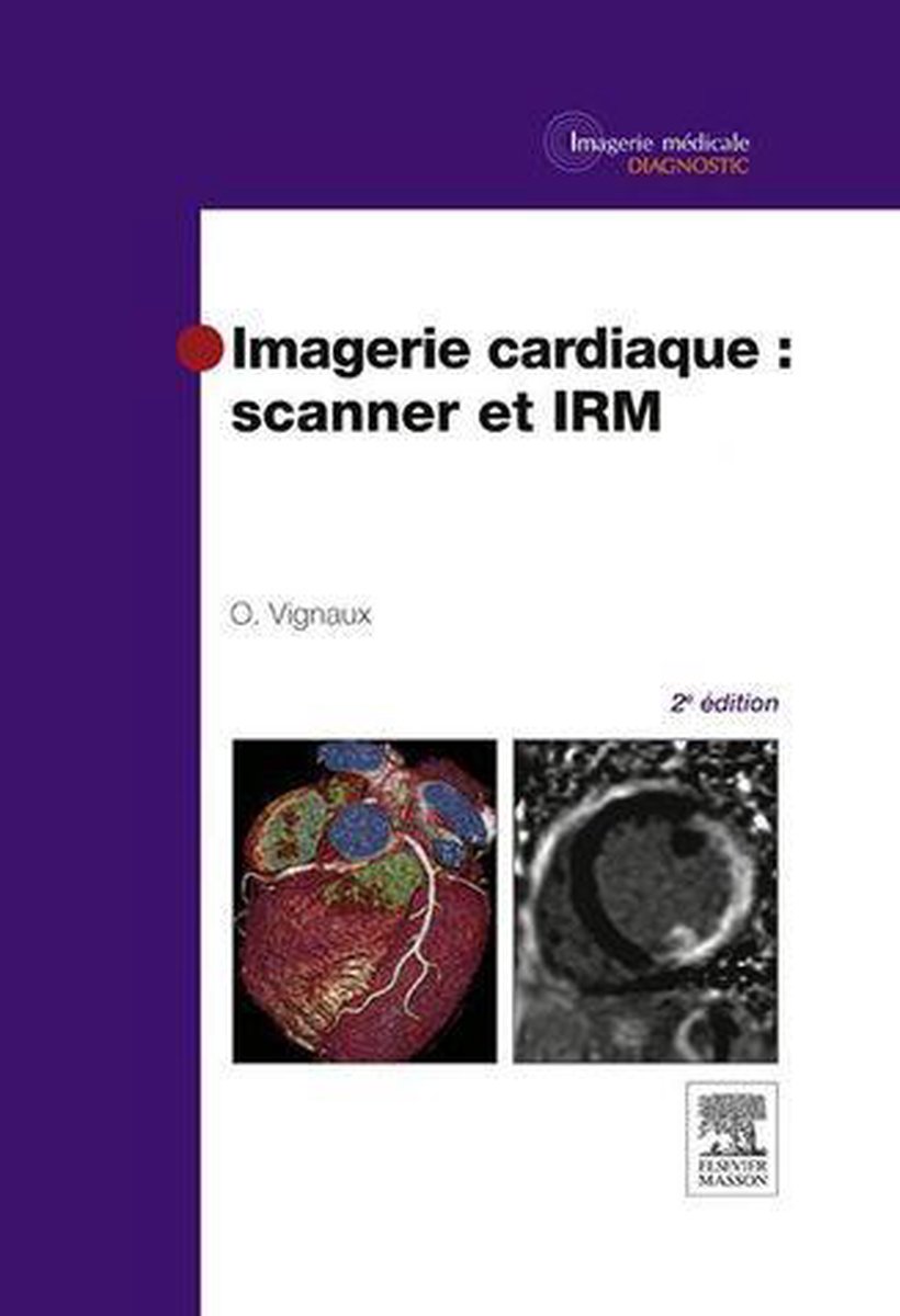 Imagerie cardiaque : scanner et IRM - Olivier Vignaux