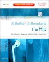 Arthritis & Arthroplasty The Hip