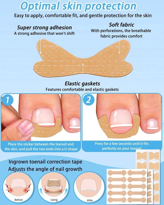 50 stuks set voor het corrigeren van ingegroeide teennagels - pijnloze gladmakingsstrips voor teennagels met teennagellifter - eenvoudige gereedschapsset voor ingegroeide teennagels — afbeelding 3
