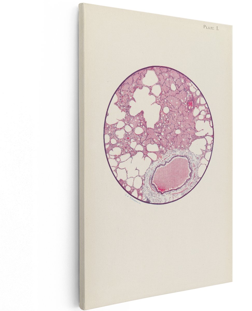 Artaza Canvas Schilderij Longweefsel - 120x180 cm - Groot - Wanddecoratie Vintage Microscoop - Muurdecoratie Anatomie - Decoratie Medisch Kantoor