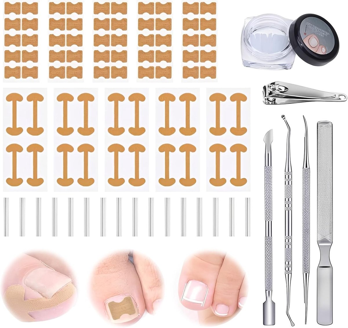Complete Oplossing voor Ingegroeide Teennagels met 15 Stuks, Nagelcorrector en Lifters voor Effectieve Verzorging