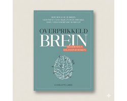 Omslag van Overprikkeld brein