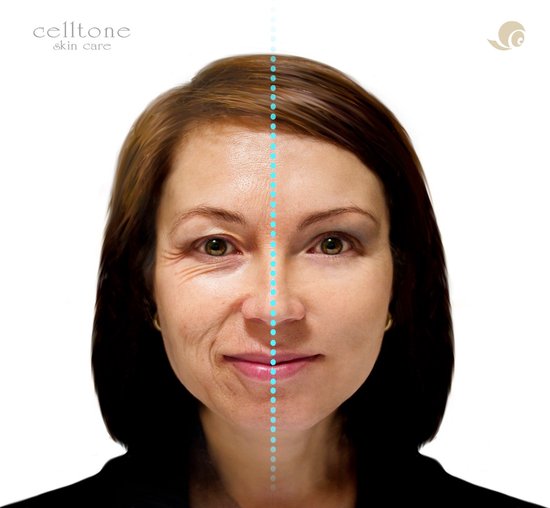 Celltone Dagcrème Slakkenslijmcrème - 50 ML - Anti rimpel - Littekencrème - Slakkencrème voor acne puistjes rimpels - Acneverzorging - Slakken Extract serum gel voor vrouwen mannen tieners - escargot cream voor gezicht en onder de ogen - Snailcare