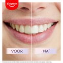 PDP.ProductImage.Thumb.Image.srtText 11