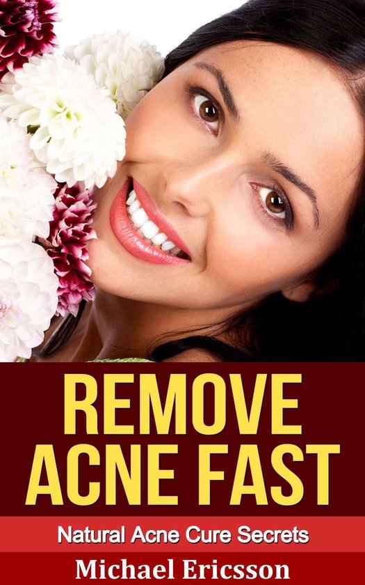 Remove Acne Fast: Natural Acne Cure Secrets - cover