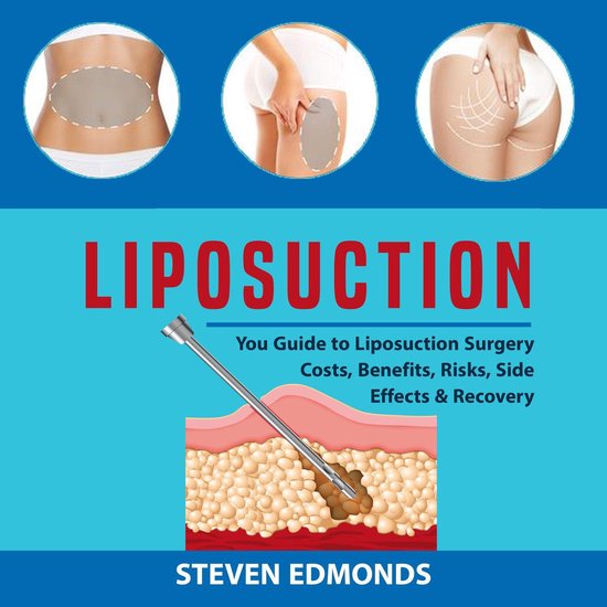 Liposuction: You Guide to Liposuction Surgery Costs, Benefit ... - cover
